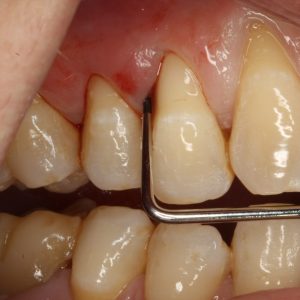 Case Study 1_Image1