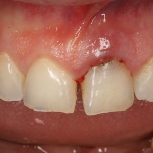 Case Study 2_Image1