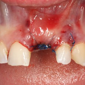 Oral-care-photos