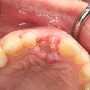 Oral-treatment