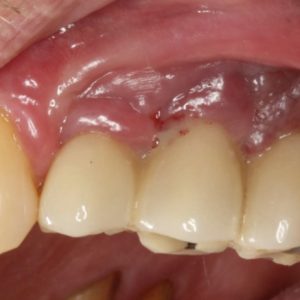 Case Study 4_Image1