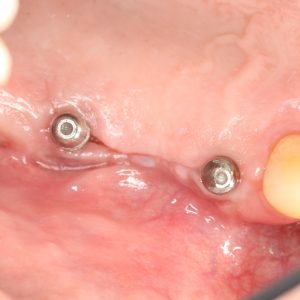 Case Study 4_Image5
