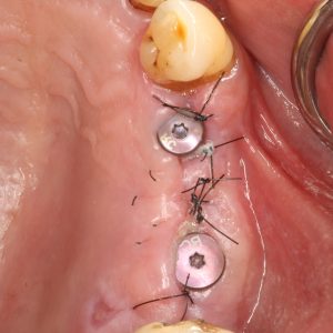 Case Study 5_Image3